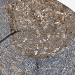 QSER1 Antibody in Immunohistochemistry (Paraffin) (IHC (P))