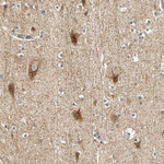 QSER1 Antibody in Immunohistochemistry (Paraffin) (IHC (P))