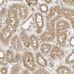 QSER1 Antibody in Immunohistochemistry (Paraffin) (IHC (P))
