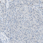 QSER1 Antibody in Immunohistochemistry (Paraffin) (IHC (P))