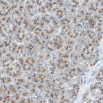 SEC16A Antibody in Immunohistochemistry (Paraffin) (IHC (P))