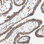 SEC16A Antibody in Immunohistochemistry (Paraffin) (IHC (P))