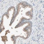 SEC16A Antibody in Immunohistochemistry (Paraffin) (IHC (P))