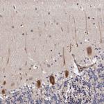 ARMX1 Antibody in Immunohistochemistry (Paraffin) (IHC (P))
