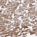 ARMX1 Antibody in Immunohistochemistry (Paraffin) (IHC (P))