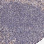 ARMX1 Antibody in Immunohistochemistry (Paraffin) (IHC (P))