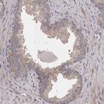 ARMX1 Antibody in Immunohistochemistry (Paraffin) (IHC (P))