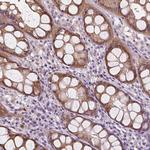 RNASE7 Antibody in Immunohistochemistry (Paraffin) (IHC (P))