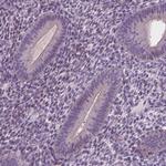 RNASE7 Antibody in Immunohistochemistry (Paraffin) (IHC (P))