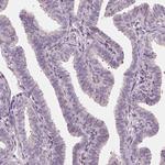 RNASE7 Antibody in Immunohistochemistry (Paraffin) (IHC (P))