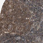 CHADL Polyclonal Antibody