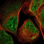 LDOC1L Polyclonal Antibody