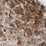 LDOC1L Antibody in Immunohistochemistry (Paraffin) (IHC (P))