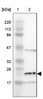 LDOC1L Antibody in Western Blot (WB)