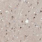 SNX4 Polyclonal Antibody