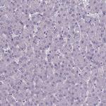 FOXJ1 Polyclonal Antibody