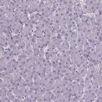 FOXJ1 Antibody in Immunohistochemistry (IHC)