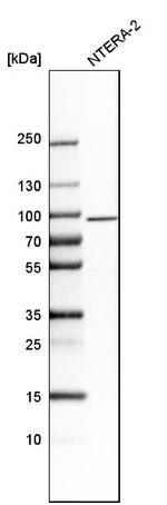 SALF Antibody in Western Blot (WB)