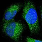 JMJD7 Polyclonal Antibody