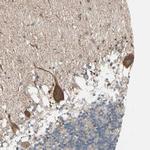 JMJD7 Antibody in Immunohistochemistry (Paraffin) (IHC (P))