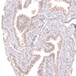 TRIP13 Polyclonal Antibody