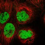 HIVEP3 Polyclonal Antibody