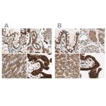 GALT Polyclonal Antibody