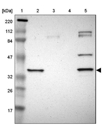 SDSL Antibody in Western Blot (WB)