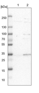 SDSL Antibody in Western Blot (WB)