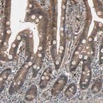 SDSL Antibody in Immunohistochemistry (IHC)