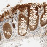 SELENBP1 Antibody in Immunohistochemistry (Paraffin) (IHC (P))