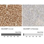 SELENBP1 Antibody in Immunohistochemistry (IHC)