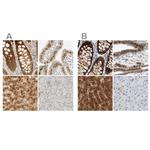 SELENBP1 Antibody in Immunohistochemistry (IHC)