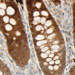 SELENBP1 Antibody in Immunohistochemistry (IHC)