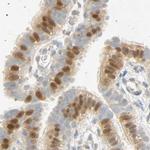 SELENBP1 Antibody in Immunohistochemistry (IHC)