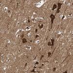N-WASP Antibody in Immunohistochemistry (IHC)