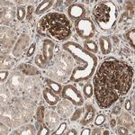 N-WASP Antibody in Immunohistochemistry (IHC)