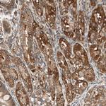N-WASP Antibody in Immunohistochemistry (IHC)