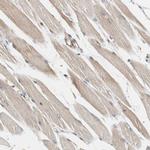 N-WASP Antibody in Immunohistochemistry (IHC)