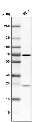 N-WASP Antibody in Western Blot (WB)