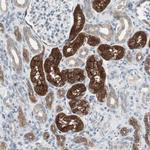 PDZK1 Antibody in Immunohistochemistry (Paraffin) (IHC (P))