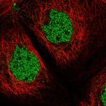 ZNF434 Polyclonal Antibody