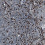 ZNF434 Antibody in Immunohistochemistry (Paraffin) (IHC (P))