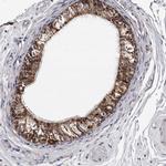 ARMX2 Antibody in Immunohistochemistry (IHC)