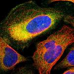 TCP11L1 Polyclonal Antibody