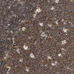 TCP11L1 Antibody in Immunohistochemistry (Paraffin) (IHC (P))