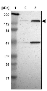 TTF2 Antibody in Western Blot (WB)
