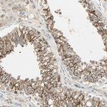 TTF2 Polyclonal Antibody