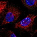 CAND2 Polyclonal Antibody