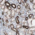 CAND2 Antibody in Immunohistochemistry (Paraffin) (IHC (P))